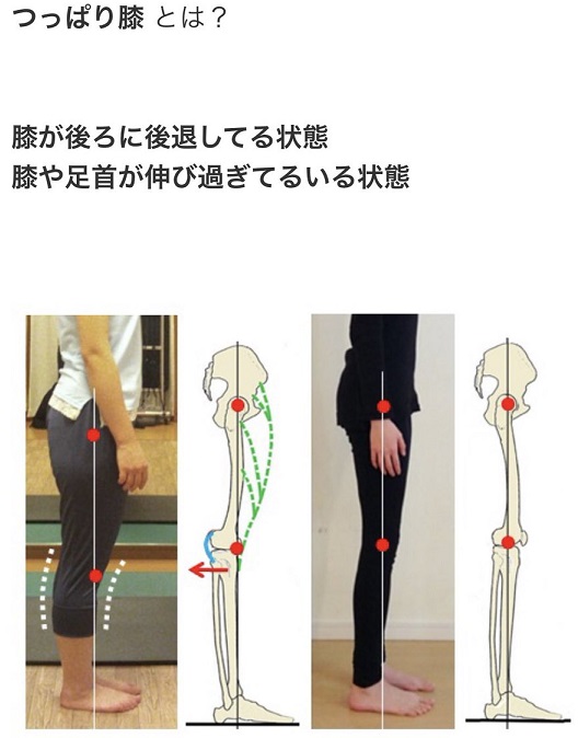 様々な画像 ここへ到着する ふくらはぎ だけ 太い