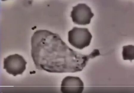 【貴重動画】人間の体内、白血球が細菌を追いかける様子が話題に